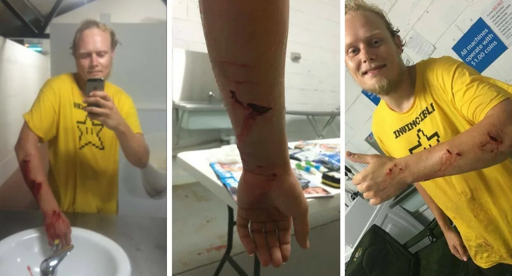 Checking out my injuries in the bathroom.