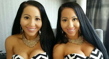 World’s most identical twins reveal next big step