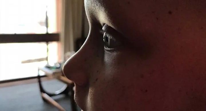 Hayley brown's eyelashes are growing back