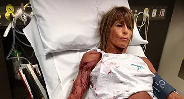 Jogger survives vicious kangaroo attack by playing dead