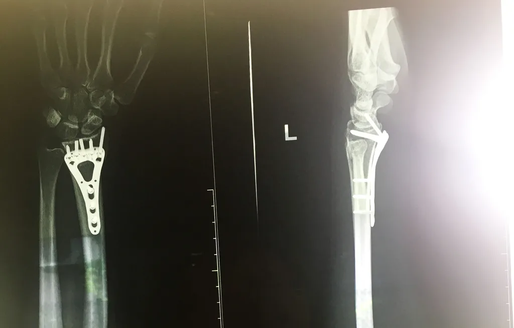 samantha tocknell x-ray