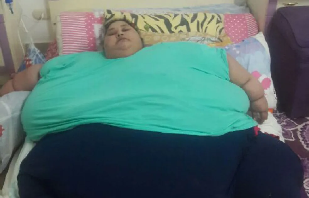 World's heaviest woman lifted by crane for lifesaving surgery that's