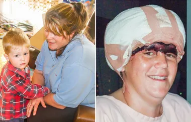 Pregnant mum SCALPED in horror farm accident tells of her ordeal and the heroes who saved her
