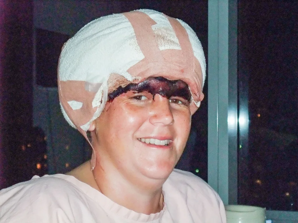 15 hours of surgery