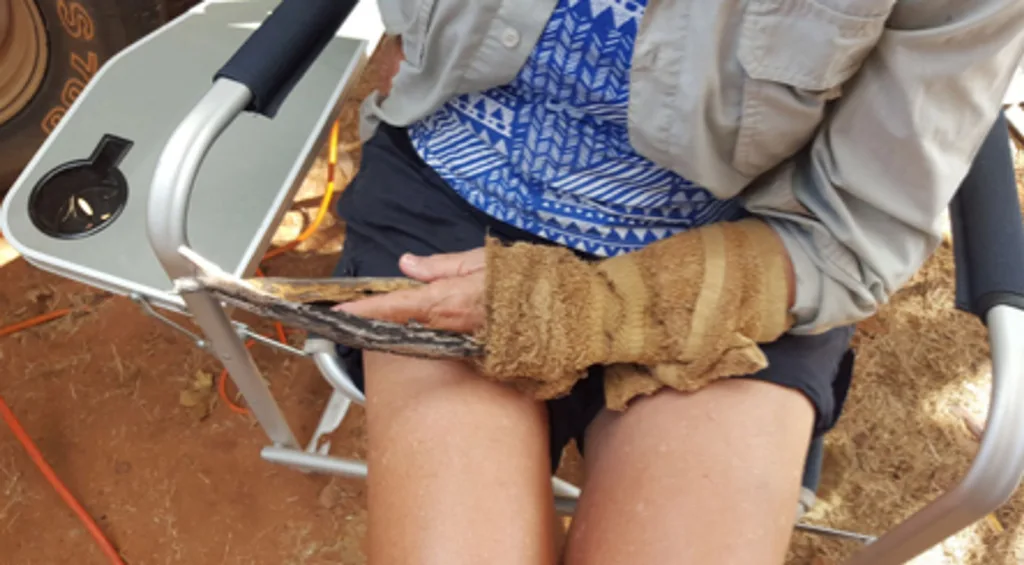 glenda's makeshift splint