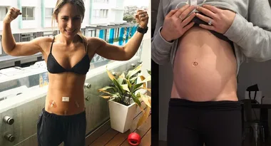 Personal trainer whose endometriosis was so painful she ‘couldn’t have sex’ reveals how she was cured