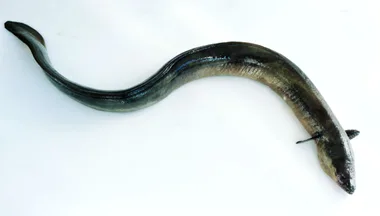 Doctors remove live eel from patient during operation