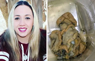 Mum becomes ill after finding ‘squid’ in her coconut water