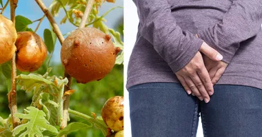 Gynecologist warning: ‘don’t put ground wasp nest in your vagina’
