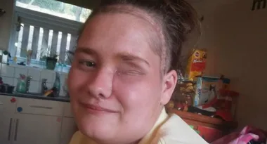 Deadly flesh-eating cancer discovered on visit to dentist