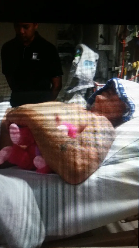 MIlton Silcock was in hospital for a month