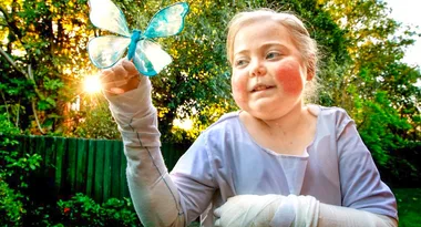 Teenage girl has rare condition that makes her skin as delicate as a butterfly’s wings