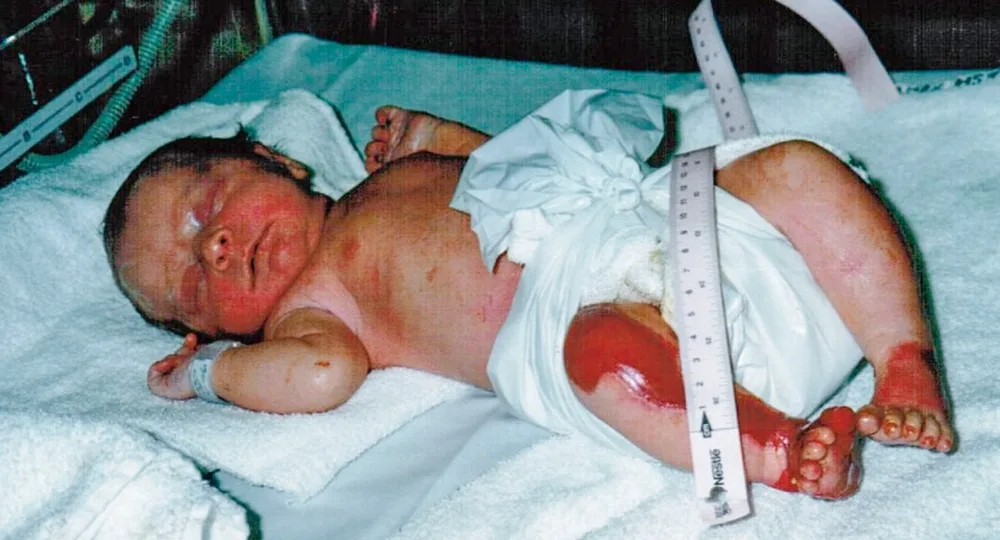 Eliza as a baby