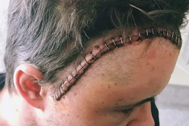 Home And Away star’s shock surgery