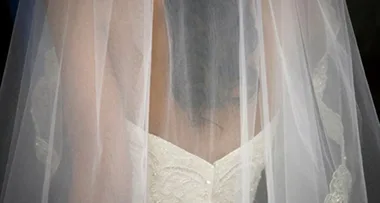 Amazing pics: Bride refuses to cover up birthmark on wedding day