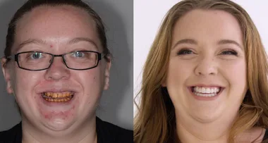 Woman’s shocking teeth transformation: ‘I didn’t even smile on my wedding day’