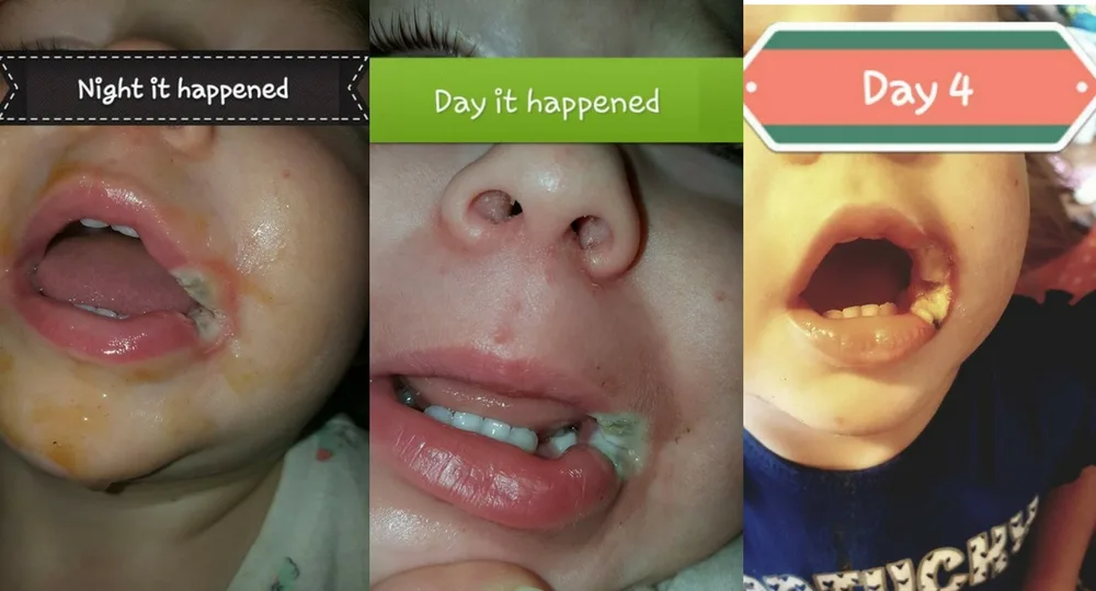 Day one to four