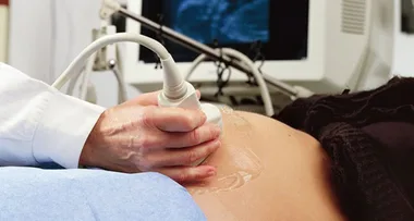 Unborn baby kicks hole through mothers womb