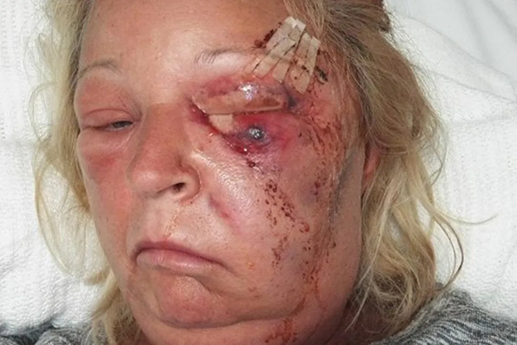 infected face