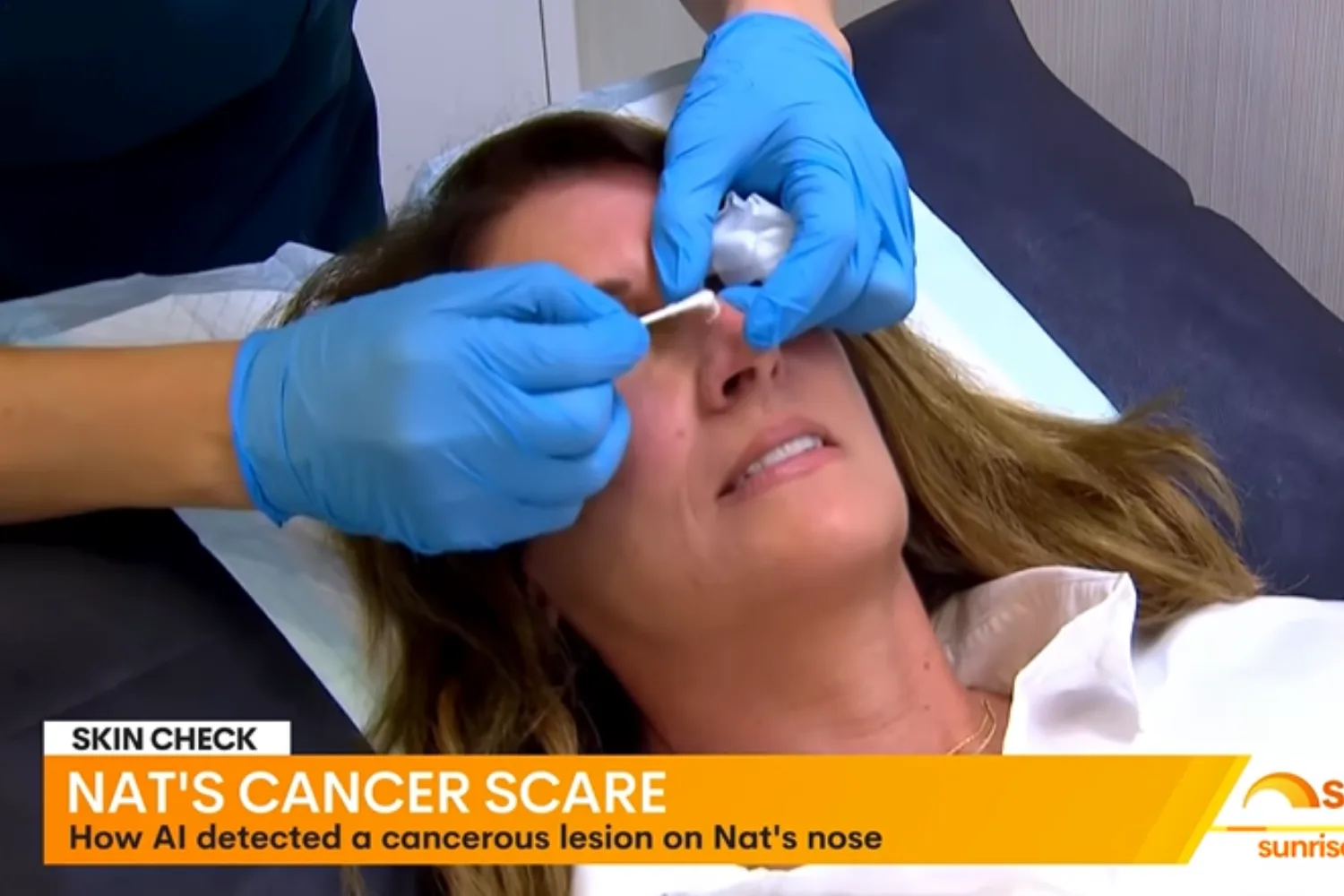 Natalie Barr skin cancer diagnosis