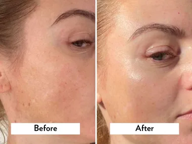 Brand behind ‘magic potion’ for dry skin launches affordable retinol booster