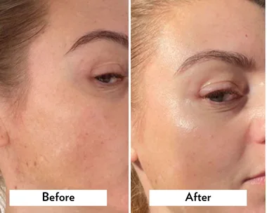 Brand behind ‘magic potion’ for dry skin launches affordable retinol booster