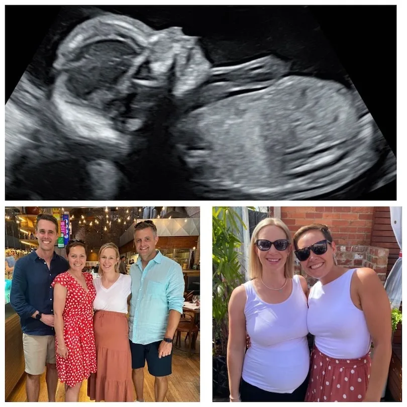 Scan of a baby and Hilland and Curry with their pregnant surrogate