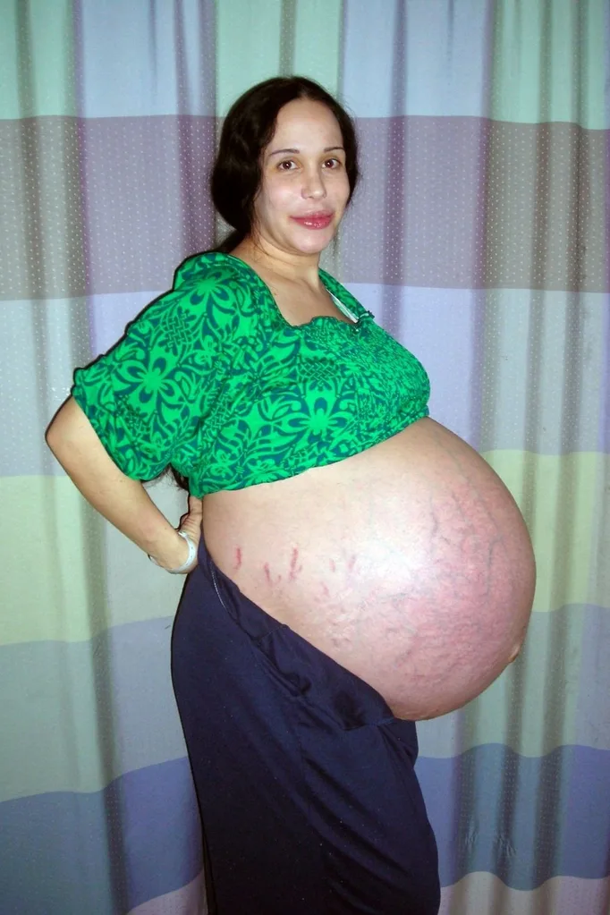 Octomum while pregnant with her octuplets