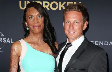 Turia Pitt and Michael Hoskin have welcomed their first baby