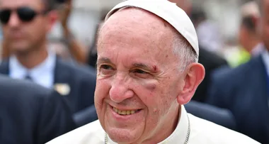 Pope Francis injured in Popemobile procession