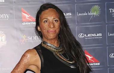 Turia Pitt shares pregnant selfie in a bikini