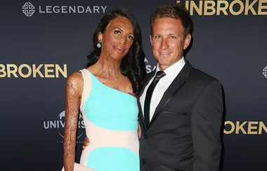 WATCH: Turia Pitt announces she is expecting baby number two