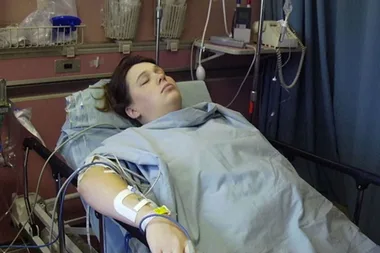 epidural