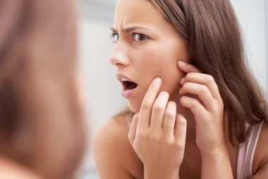 Could your gut be responsible for your breakouts?