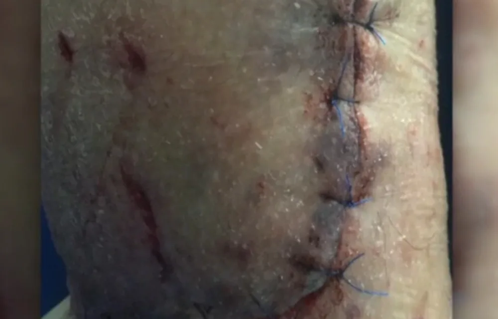 A Palmyra grandmother suffered injuries when she was attacked by two pit bulls.