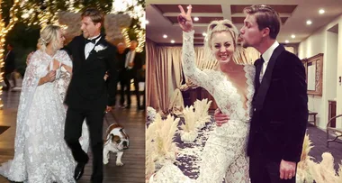Kaley Cuoco reveals she underwent shoulder surgery on Honeymoon