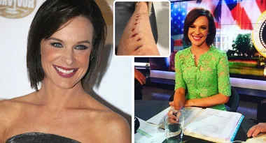 Natarsha Belling reveals gruesome injury on Instagram