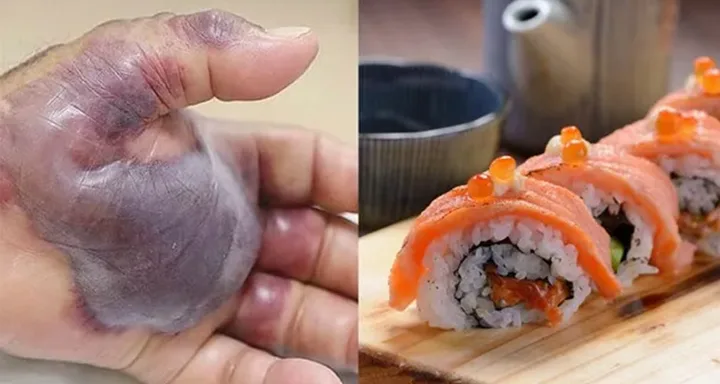 sushi