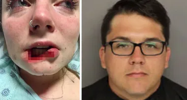 Woman, Whose Ex Bit Off Her Lip, Shares Emotional Facebook Post After He Is Sentenced to Prison