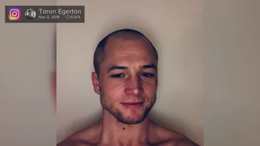 Taron Egerton Opens Up About Significance Behind New Look