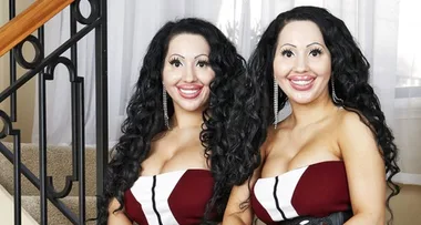 Identical twins Anna and Lucy Decinque reverse plastic surgery: “We’re all natural now!”