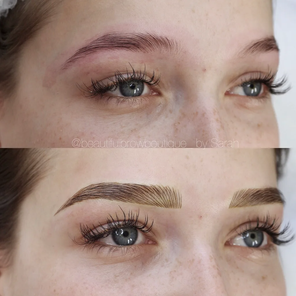 Before and after