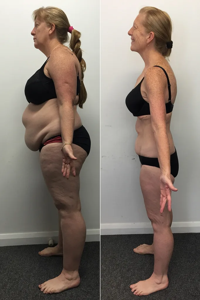 weight loss