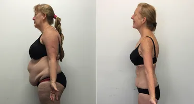 WHO reader Deb lost 37kgs
