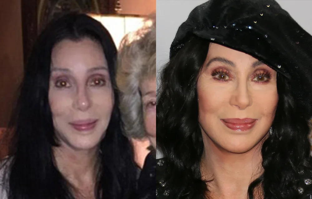 cher