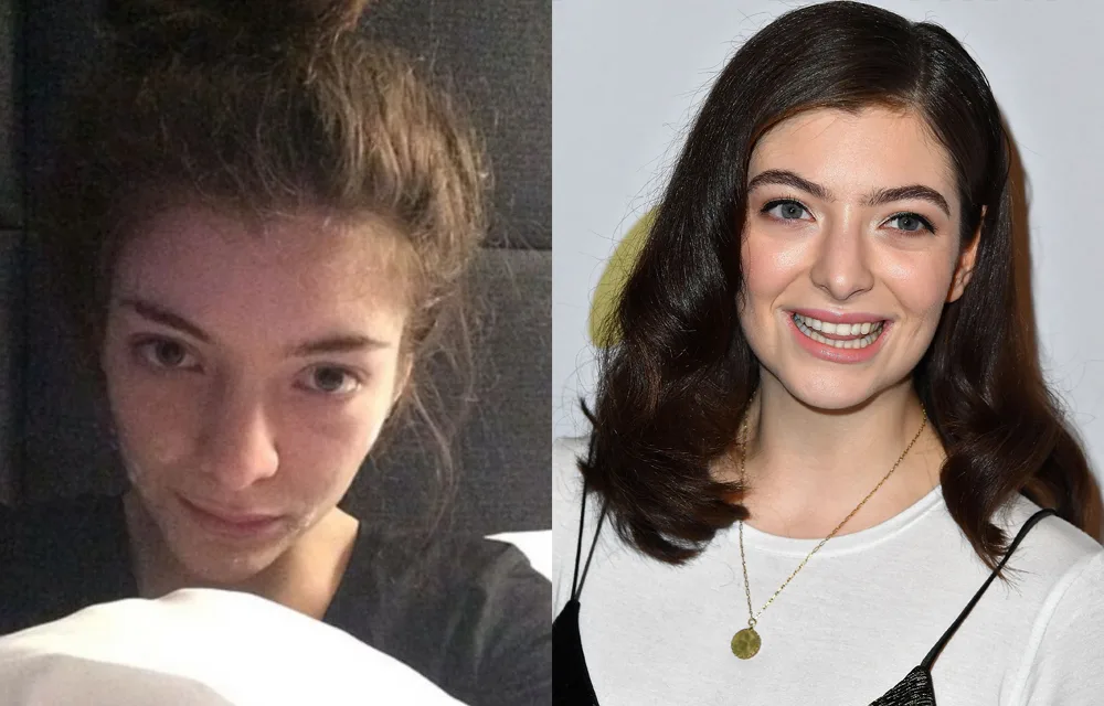 Lorde