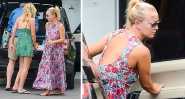 EXCLUSIVE: Jackie O sports a nasty head injury after fun girl’s trip with Sophie Monk