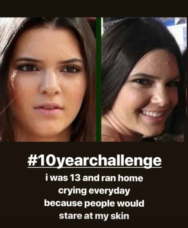 Kendall Jenner