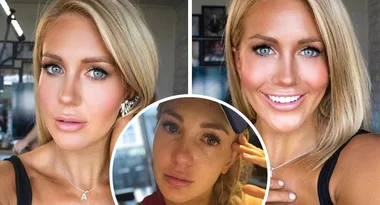 Ali Oetjen breaks her silence on face photoshop