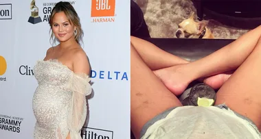 The celebrity-approved products for preventing stretch marks